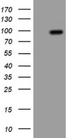 TUBAL3 Antibody