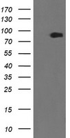 TUBAL3 Antibody