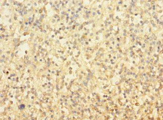 TUBAL3 Antibody
