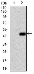 TUBB1 Antibody