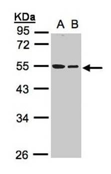TUBB1 antibody