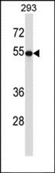 TUBB2A antibody