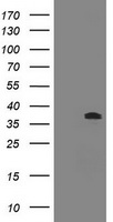 TUBB2B Antibody