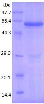 Tubulin beta 3 protein