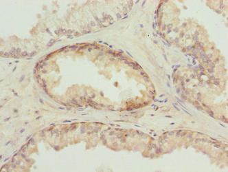 TUBB6 Antibody