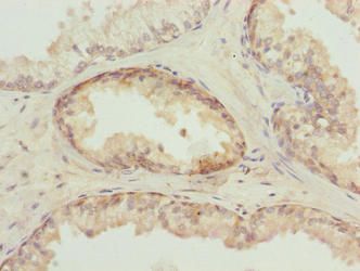 TUBB6 antibody