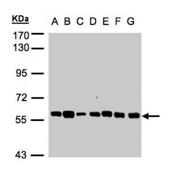 Tubby-related protein 1 antibody