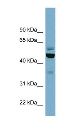 TUBE1 antibody
