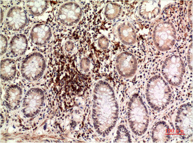 TUBE1 antibody