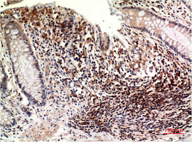 TUBE1 antibody