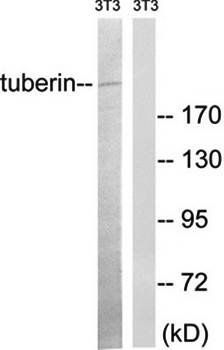 Tuberin antibody