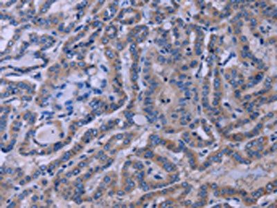 TUBGCP2 Antibody