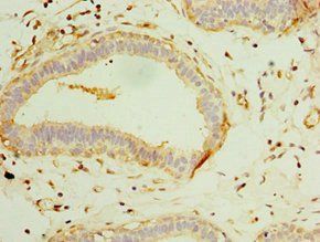 TUBGCP3 Antibody