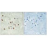 TUBGCP6 Antibody