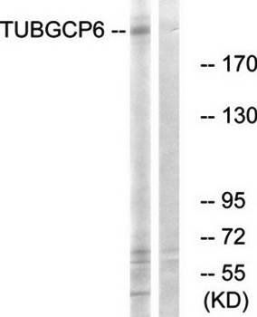 TUBGCP6 Antibody