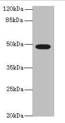 TUBB1 Antibody