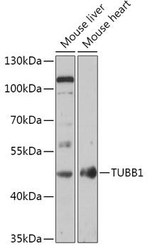 Tubulin beta 1 antibody