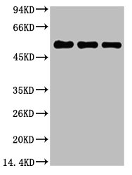 Tubulin beta 1 antibody