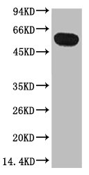 TUBB1 Monoclonal Antibody