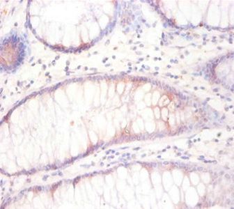 TUBB3 Antibody