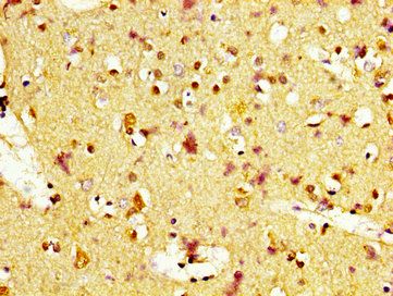 MC1R Antibody