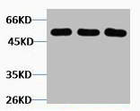 Tubulin beta 3 antibody