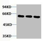 Tubulin beta 3 antibody