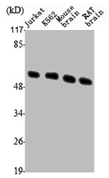 Tubulin beta 3 antibody