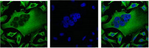 TUBB3 Monoclonal Antibody