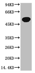 TUBB3 Monoclonal Antibody