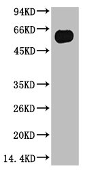 TUBB3 Monoclonal Antibody