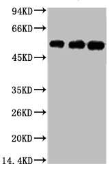TUBB3 Monoclonal Antibody