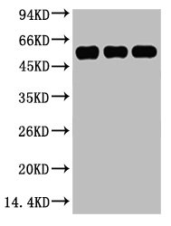 TUBB3 Monoclonal Antibody