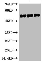 TUBB3 Monoclonal Antibody