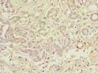 TBCC Antibody