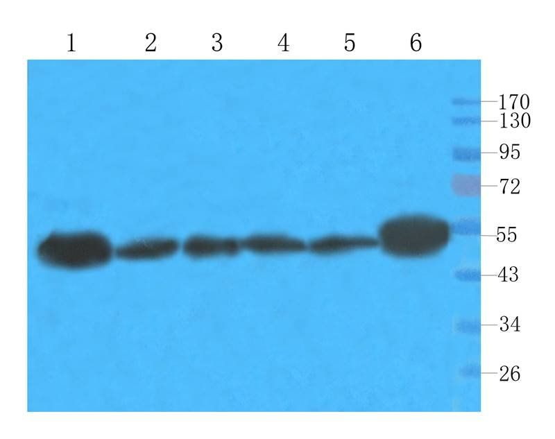 Tubulin beta 3 antibody