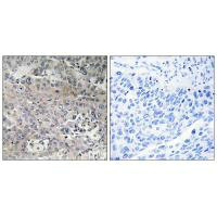 TUFM Antibody