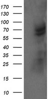 TULP3 antibody