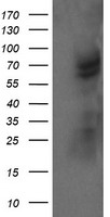 TULP3 Antibody