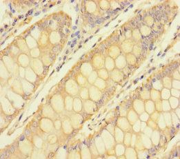 TULP3 Antibody