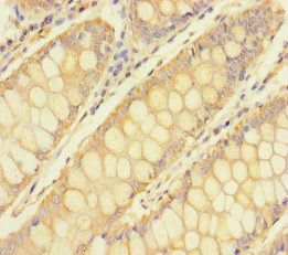 TULP3 antibody