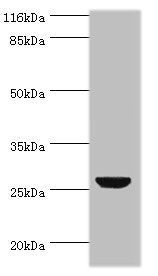 Tumor necrosis factor antibody