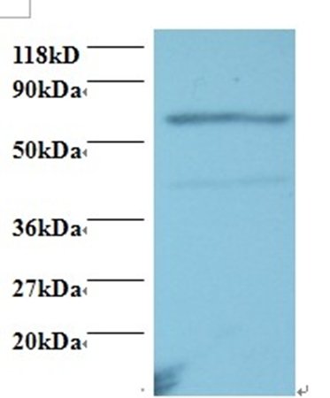 Tumor necrosis factor R superfamily member 11A antibody (Biotin)