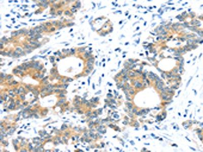 TUSC1 Antibody