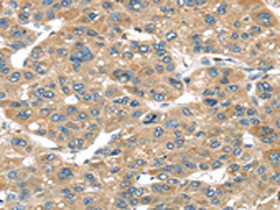 TUSC1 antibody