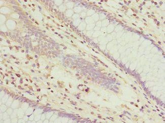 TUSC2 Antibody