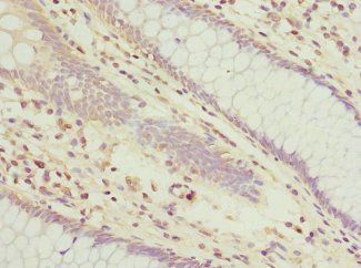 TUSC2 antibody