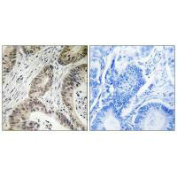 TUT1 Antibody