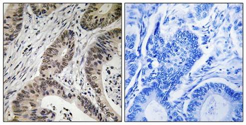 TUT1 antibody