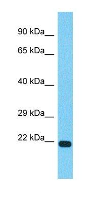TVP23C antibody